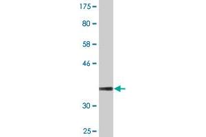 Western Blot detection against Immunogen (36. (TCP11 antibody  (AA 342-441))