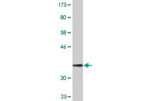 Western Blot detection against Immunogen (36. (TCP11 antibody  (AA 342-441))