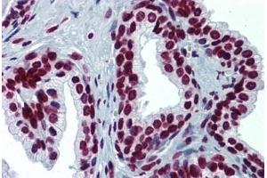 Human Prostate: Formalin-Fixed, Paraffin-Embedded (FFPE)