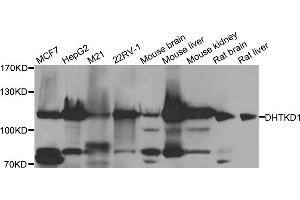Western blot analysis of extracts of various cell lines, using DHTKD1 antibody.