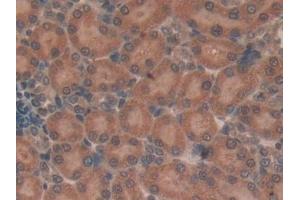 Detection of TUBd in Rat Kidney Tissue using Polyclonal Antibody to Tubulin Delta (TUBd) (TUBD1 antibody  (AA 238-482))