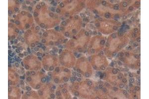 Detection of TUBd in Rat Kidney Tissue using Polyclonal Antibody to Tubulin Delta (TUBd)