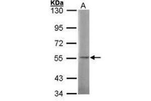 Image no. 1 for anti-N-Sulfoglucosamine Sulfohydrolase (SGSH) (AA 44-200) antibody (ABIN467364) (SGSH antibody  (AA 44-200))