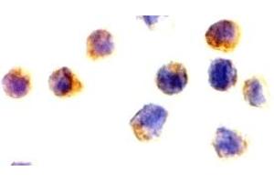 Immunohistochemistry (IHC) image for anti-Apoptosis-Inducing Factor, Mitochondrion-Associated, 1 (AIFM1) (N-Term) antibody (ABIN1031220) (AIF antibody  (N-Term))