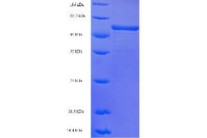 SDS-PAGE (SDS) image for ATPase, Ca++ Transporting, Cardiac Muscle, Slow Twitch 2 (ATP2A2) (AA 314-756) protein (His tag) (ABIN5709099)