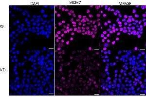 Immunocytochemical staining of HeLa cells using MCM7 antibody (ABIN7799424), 1:1,000), Top panel: wild-type (WT), Bottom panal: MCM7 shRNA knockdown (KD).