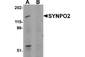 Western Blotting (WB) image for anti-Synaptopodin 2 (SYNPO2) (N-Term) antibody (ABIN1031593) (SYNPO2 antibody  (N-Term))