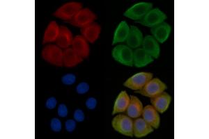 ABIN7095404 and ABIN7099461 staining Hela cells(45 min of heat-shock treatment) by IF/ICC.