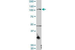 CTNNA3 MaxPab rabbit polyclonal antibody. (CTNNA3 antibody  (AA 1-516))