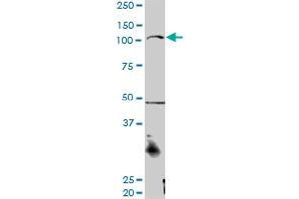 CTNNA3 antibody  (AA 1-516)