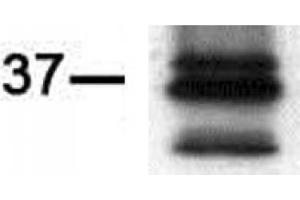 Western blot of PIM2 antibody (mAb). (PIM2 antibody)
