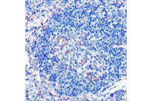 Immunohistochemistry of paraffin-embedded mouse spleen using CD86 Rabbit pAb (ABIN6131556, ABIN6138237, ABIN6138238 and ABIN6219508) at dilution of 1:100 (40x lens). (CD86 antibody  (AA 30-247))