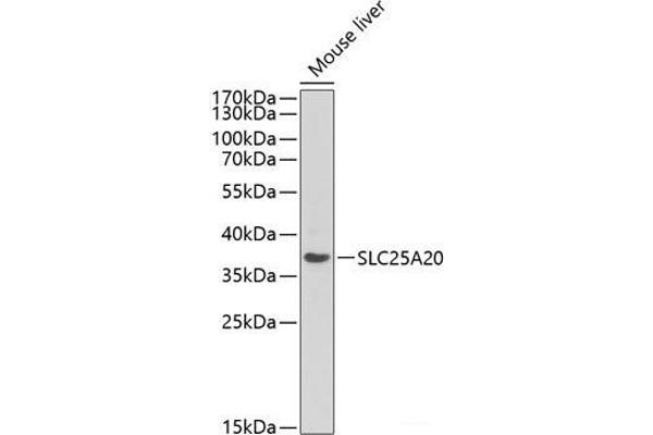 SLC25A20 anticorps
