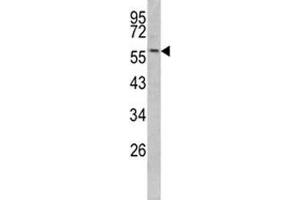 Western blot analysis of Keratin-14 antibody and mouse NIH3T3 lysate (KRT14 antibody  (AA 276-303))