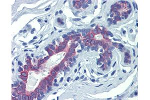 Anti-LIMD1 antibody IHC of human breast. (LIMD1 antibody  (N-Term))
