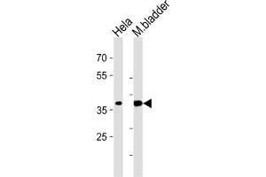 Western Blotting (WB) image for anti-Eukaryotic Translation Initiation Factor 3 Subunit H (EIF3H) antibody (ABIN3002723) (EIF3H antibody)