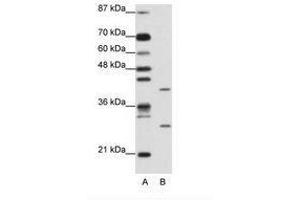Image no. 1 for anti-ZFP36 Ring Finger Protein-Like 1 (ZFP36L1) (AA 46-95) antibody (ABIN202274)