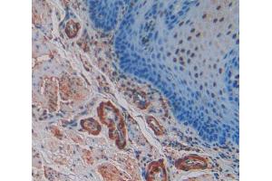 Used in DAB staining on fromalin fixed paraffin- embedded esophagus cancer tissue (SNCG antibody  (AA 1-121))