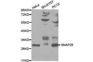 Western Blotting (WB) image for anti-Synaptosomal-Associated Protein, 25kDa (SNAP25) antibody (ABIN1874885) (SNAP25 antibody)