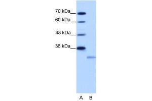 EIF4E2 antibody used at 2.