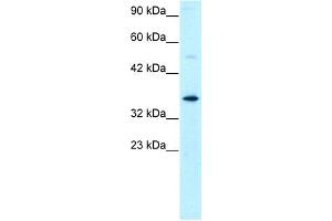 WB Suggested Anti-GTF2H3 Antibody Titration: 0. (GTF2H3 antibody  (N-Term))