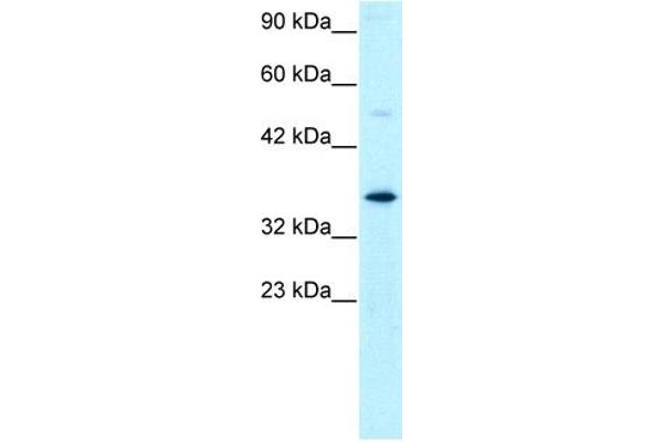 GTF2H3 antibody  (N-Term)