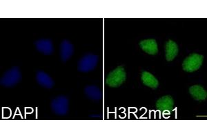 Immunofluorescence analysis of 293T cells using H3R2me1 antibody (ABIN3017476, ABIN3017477, ABIN3017478 and ABIN6220105). (Histone 3 antibody  (H3R2me))