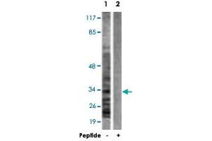 Western blot analysis of extracts from A-431 cells, using CASP6 polyclonal antibody . (Caspase 6 antibody)
