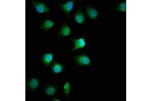Immunofluorescence staining of A549 cells with ABIN7153110 at 1:100, counter-stained with DAPI. (FMN1 antibody  (AA 354-487))