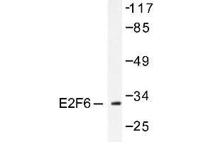 Image no. 1 for anti-E2F Transcription Factor 6 (E2F6) antibody (ABIN265390) (E2F6 antibody)
