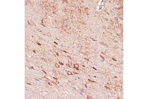 Immunohistochemistry of paraffin-embedded rat brain using OR10H3 antibody (ABIN7269086) at dilution of 1:100 (40x lens). (OR10H3 antibody  (AA 1-100))