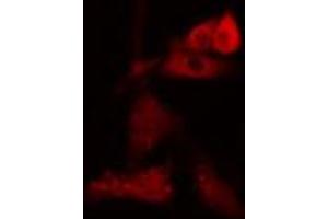 ABIN6274091 staining Hela cells by IF/ICC.