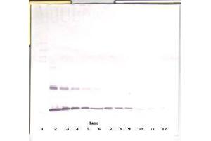 Image no. 5 for anti-Interleukin 1 alpha (IL1A) antibody (ABIN465571)