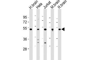 CHST1 anticorps  (C-Term)