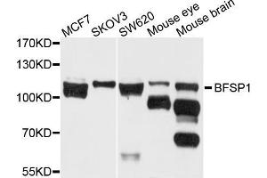 Western blot analysis of extracts of various cell lines, using BFSP1 antibody (ABIN5971950) at 1/1000 dilution. (Filensin antibody)