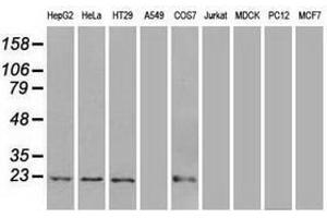 Image no. 2 for anti-Adenylate Kinase 1 (AK1) antibody (ABIN1496515) (Adenylate Kinase 1 antibody)