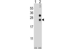 Western Blotting (WB) image for anti-Casein alpha S1 (CSN1S1) antibody (ABIN2997019)