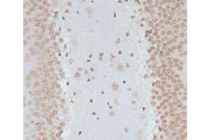 Immunohistochemistry (Paraffin-embedded Sections) (IHC (p)) image for anti-Tumor Protein P53 (TP53) (pSer33) antibody (ABIN7265276)
