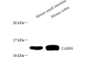 Western blot analysis of FABP6 (ABIN7073921) at dilution of 1: 1000 (FABP6 antibody)