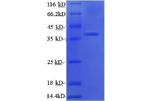 SDS-PAGE (SDS) image for Apurinic/Apyrimidinic Endonuclease 1 (APEX1) (AA 32-318) protein (His tag) (ABIN5713236) (APEX1 Protein (AA 32-318) (His tag))