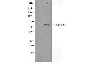 Western blot analysis on HeLa cell lysate using Caspase 10 Antibody,The lane on the left is treated with the antigen-specific peptide. (Caspase 10 antibody)