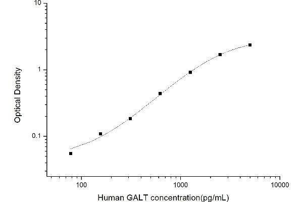 GALT ELISA Kit