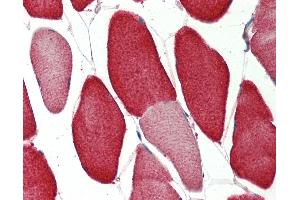 Human Skeletal Muscle: Formalin-Fixed, Paraffin-Embedded (FFPE) (VAMP2 antibody  (AA 1-66))
