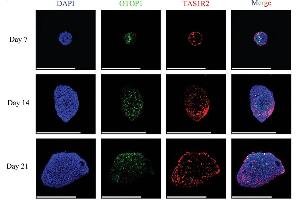 Immunostaining images showing the distribution of OTOP1 and TAS1R2 on the taste organoid cultured for 7, 14, or 21 days. (PKD2L1 antibody)