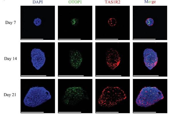 PKD2L1 antibody