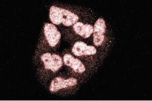 Immunofluorescence staining of HeLa cells (Human cervical epitheloid carcinoma, ATCC CCL-2.
