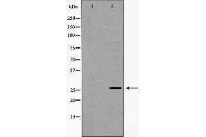 Western blot analysis of extracts of HeLa , using NQO2 antibody. (NQO2 antibody  (N-Term))