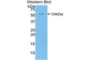 Western Blotting (WB) image for anti-Epidermal Growth Factor Receptor 2 (EGFR2) (AA 376-578) antibody (FITC) (ABIN1175126) (EGFR2 antibody  (AA 376-578) (FITC))