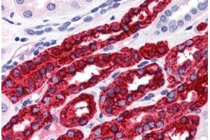 Human Kidney (formalin-fixed, paraffin-embedded) stained with UMOD antibody ABIN364281 at 20 ug/ml followed by biotinylated anti-mouse IgG secondary antibody ABIN481714, alkaline phosphatase-streptavidin and chromogen. (Uromodulin antibody)