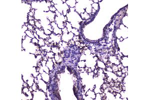 IHC analysis of FABP5 using anti-FABP5 antibody . (FABP5 antibody)